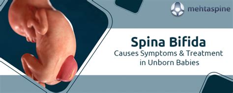 bufuda|Spina Bifida: Causes, Symptoms, Diagnoses, and Treatment